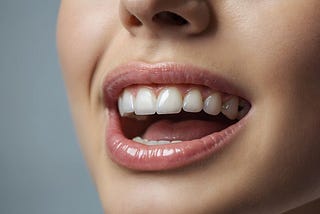 Best Teeth Whitening for Sensitive Teeth: An In-Depth Opinion