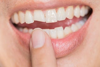 Iqaluit Dental Clinic image of a person with nice white teeth.