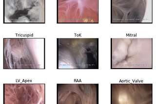 Teaching a Neural Network Cardiac Anatomy