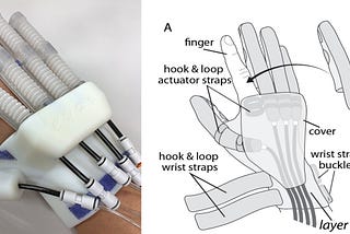 Soft Robotic Hand for Stroke Rehabilitation