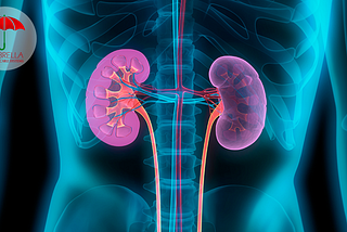 Kidney Failure: A Simple Guide To Understand The Condition