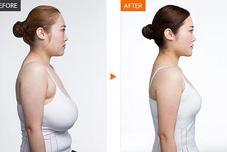 What Should be the Minimum Size for Breast Reduction