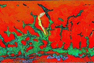 The Connection — Chapter XI