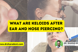 What are Keloids that develop after Ear and Nose Piercing?