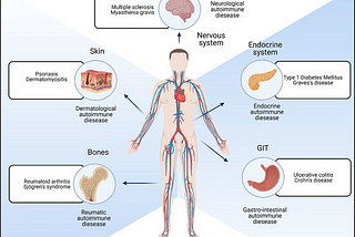 Autoimmune Disease: The Next Frontier in Gene Therapy?