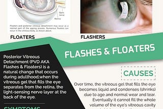 Unraveling the Mystery of Floaters and Flashes in Your Vision