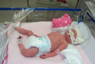 Bebê luta pela vida após nascer com 15 buracos no coração e contrair meningite na hora do parto