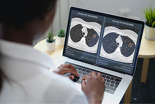 Revolutionizing Cancer Detection and Diagnosis with Artificial Intelligence in Healthcare