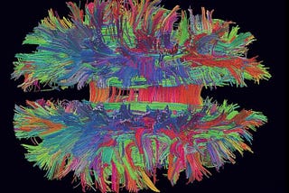The Enigma of The Human Brain