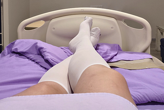 Author’s legs in a hospital bed with purple sheets and compression socks.