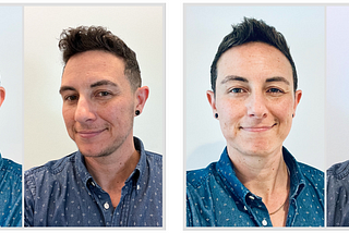 comparison photos from 3 months vs. 13 months on testosterone