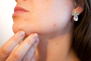 9 COMMON SKIN CARE MISTAKES