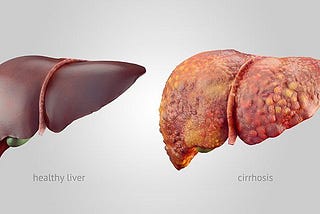 Say Goodbye to Toxins and Hello to a Healthy Liver!