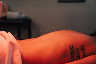 Looking for Natural Pain Relief in New Albany, Ohio? Consider Acupuncture