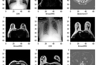 Disease Classification using Medical MNIST