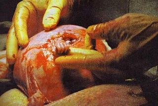 Why Abortion is the Greatest Human Rights Crisis of Our Time