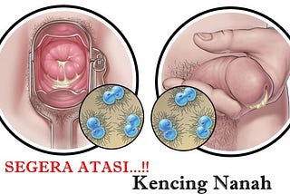 Obat Untuk Kencing Bernanah Yang Ampuh Dan Murah