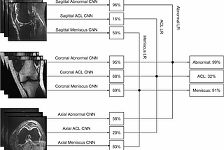 MRNet: Deep-learning-assisted diagnosis for knee MRI scans