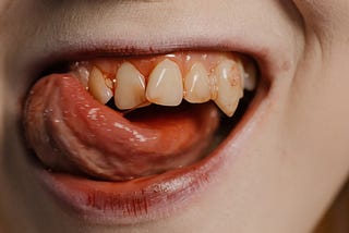 Close-up of a blood-stained mouth in a pale-skinned face. The mouth is open in a sly grin, showing crooked teeth covered in blood. The tongue curls around the teeth to the person’s right, while a sharp fang is visible on their left.