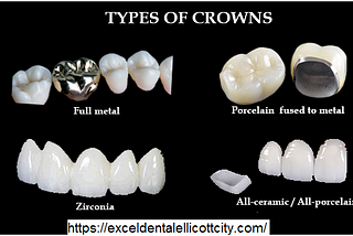 Types Of Crowns