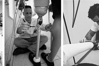Evolution of Prosthetics, A Case Study