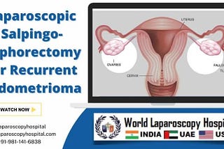 Laparoscopic Salpingo-oophorectomy for Recurrent Endometrioma