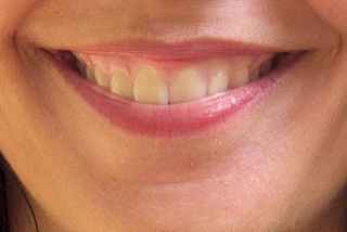 Le sourire