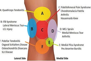 A Comprehensive Guide about Knee Pain Location Chart