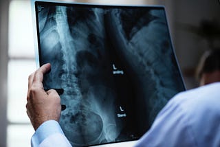 What You Should Know About Being a Radiology Technologist