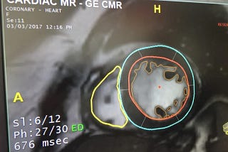 The Future of Cardiac Imaging: Leveraging Synthetic Image Data for Improved Cardiac Function…