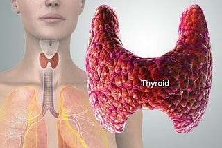 12 Signs You May Have A Thyroid Problem and Common Conditions