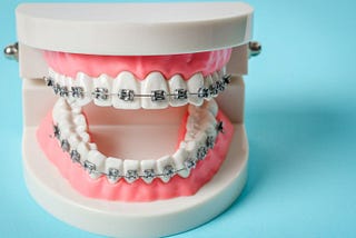 Metal Braces for Adults: Breaking the Stigma