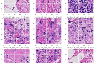 Histopathologic cancer detection as image classification using Pytorch