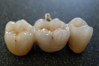 Global Zirconia-Based Dental Ceramics Market to Soar at 9.1%