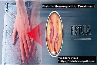 Healing Naturally: The Ultimate Fistula Homeopathic Treatment Guide