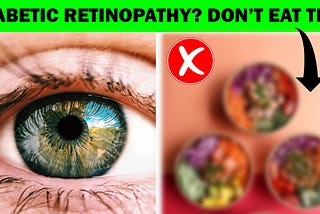 Diabetic Retinopathy | 5 Healthy Food You Should Eat and Avoid
