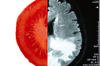 From Tomatoes to Tumors: