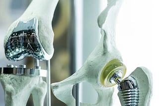 Need for Orthopedic implants and their advantages
