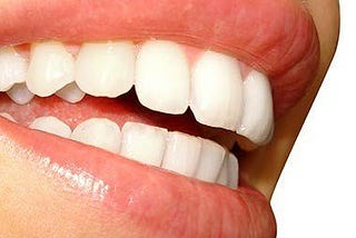Teeth Whitening That Works