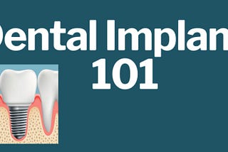 Dental Implants 101