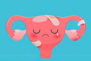 PCOS Epidemic — Which type of PCOS do you have?