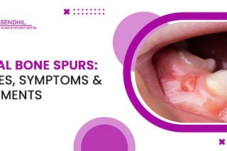 Dental Bone Spurs: Causes, Symptoms, Treatment