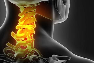 Preventing Slipped Discs in the Neck in the Modern Age