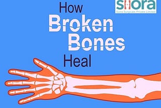 Fracture Healing — An Educational Guide