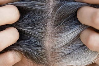 Causes Of Hair Graying