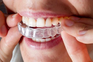 Invisalign Is Very Useful for The Jaw and Teeth