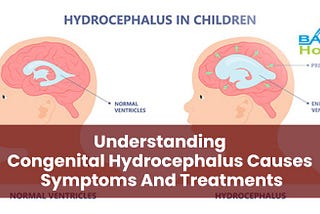 The Causes, Symptoms, and Treatments of Congenital Hydrocephalus