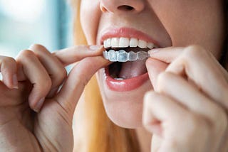Clear Teeth Aligners in Bakersfield: The Modern Solution to a Perfect Smile