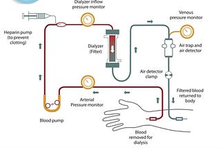 Dialysis in delhi