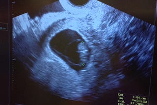 I’m 41, Single and Pregnant.